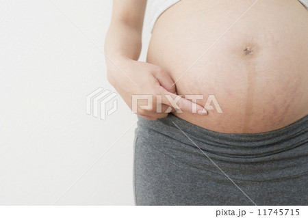 妊娠線 妊娠線 11745715