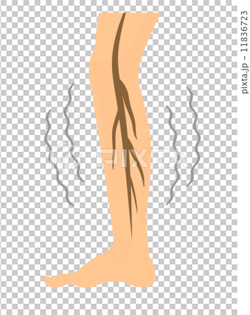 足のしびれ 11836723