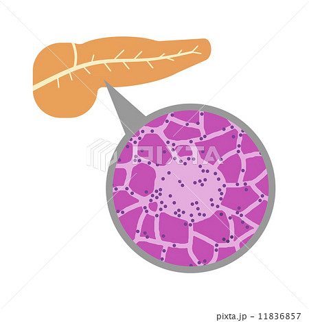 すい臓の中のランゲルハンス島のイラスト素材