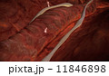 A human vein 11846898