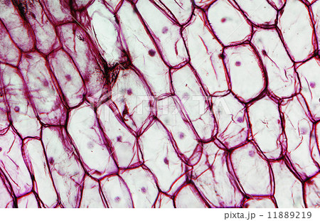Onion epidermus micrograph Onion epidermus micrograph 11889219