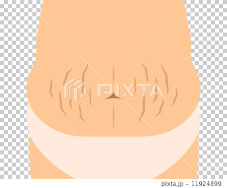 Stomach Fracture Stock Illustration