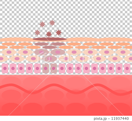 皮膚粗糙的部分 11937440