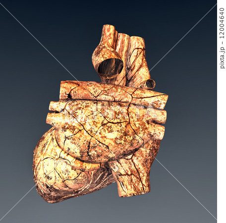 Model of ruined human heart Model of ruined human heart 12004640