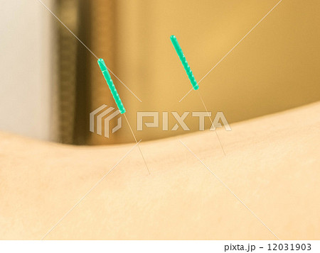鍼（はり） 12031903