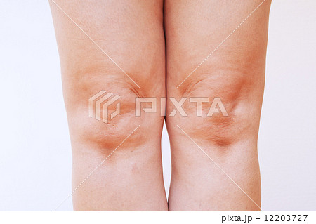 40代女性の膝 40代女性の膝 12203727