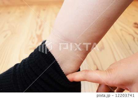 浮腫んだ足のイメージ 浮腫んだ足のイメージ 12203741