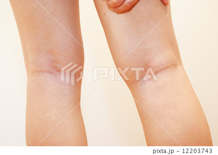 40代女性の脚 12203743