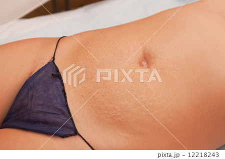 skin stretch skin stretch 12218243