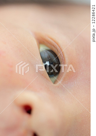 生後1ヶ月 赤ちゃん 黄疸の写真素材