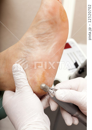 Remove dry skin 12520702