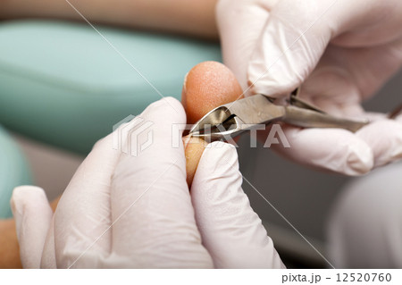 Edit toenail with nipper 12520760