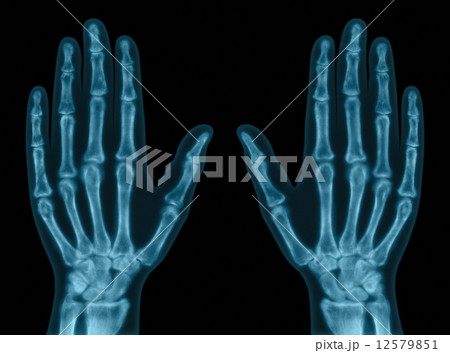 Hand Bones 12579851