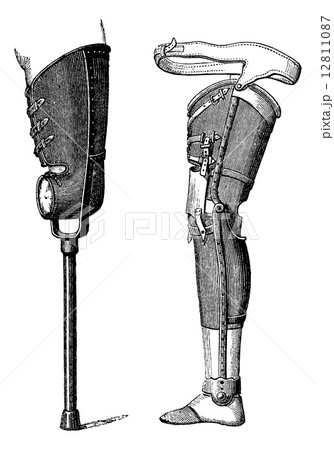 Artificial Legs, vintage engraving 12811087