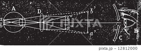 Ophthalmoscopic examination was the inverted image, vintage engr Ophthalmoscopic examination was the inverted image, vintage engr 12812000