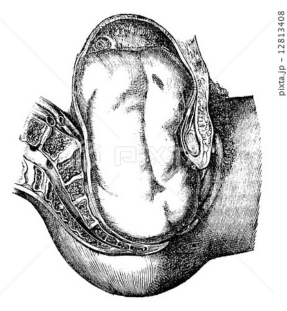 Their expulsion of the buttocks, vintage engraving. 12813408