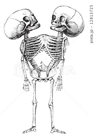 Monster Sternopage, vintage engraving. 12813725