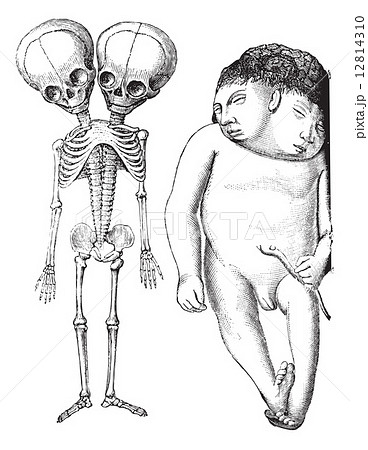 Fig 174 Skeleton Of Two Headed Monster のイラスト素材