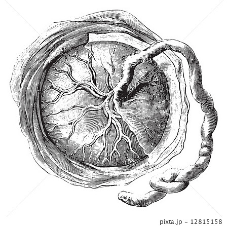 Placenta (internal or fetal face), vintage engraving. Placenta (internal or fetal face), vintage engraving. 12815158