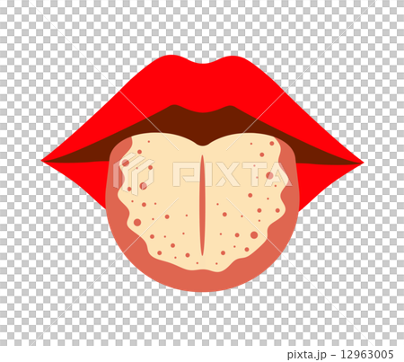 Tongue tongue 12963005