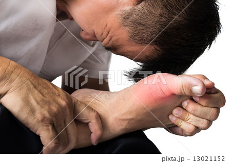 Man with painful and inflamed gout on big toe area 13021152