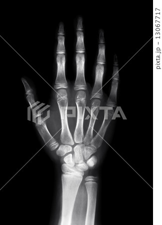 Human hand Human hand 13067717