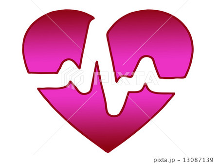 心電図 13087139
