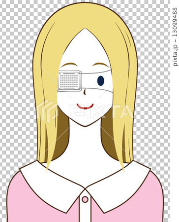 女性　眼帯 13099488