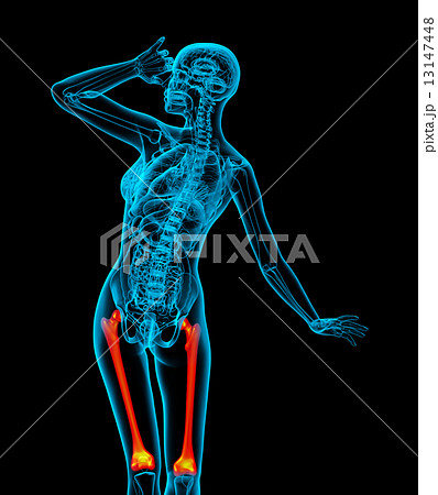 3d render medical illustration of the femur bone 13147448