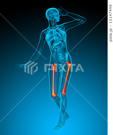 3d render medical illustration of the femur bone 13147449