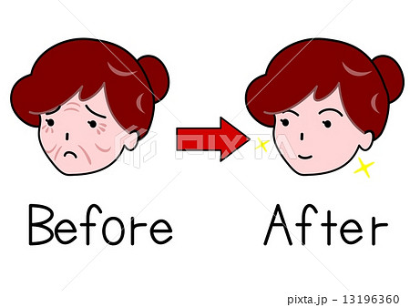 しわの女性と美肌の女性 13196360