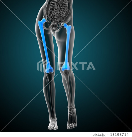 3d render medical illustration of the femur bone 13198714