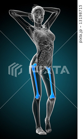 3d render medical illustration of the femur bone 13198715