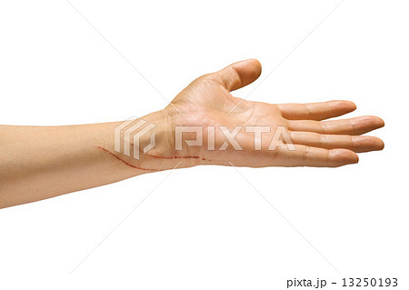 猫の引っ掻き傷 猫の引っ掻き傷 13250193