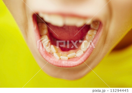 Teeth 13294445
