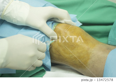 Surgeon and male patient injection human growth factors 13472578