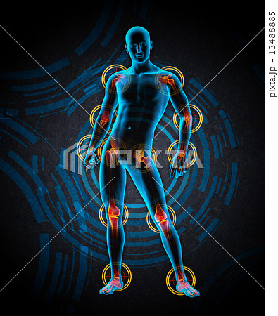 3d rendered medical illustration of a painful joint 13488885