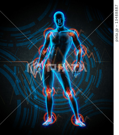 3d rendered medical illustration of a painful joint 13488887