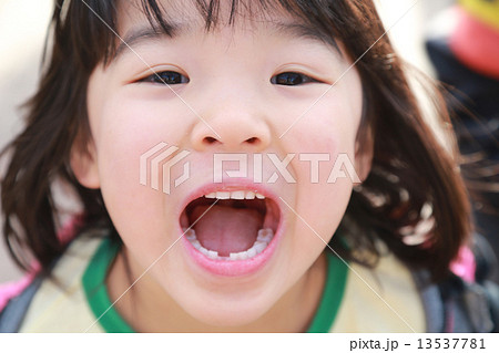 歯が抜けたよ！ 13537781