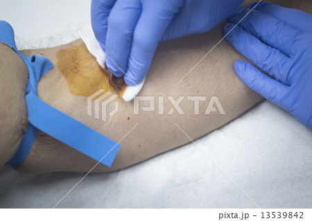 Nurse and male patient blood sample donation 13539842