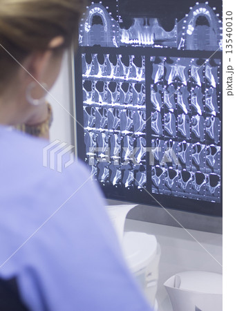 Dental xray scan on viewer in dentist clinic 13540010