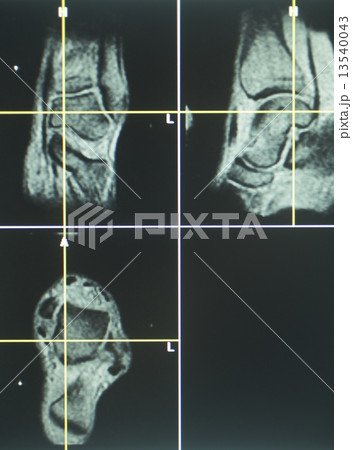 Human knee open MRI CT scan Human knee open MRI CT scan 13540043