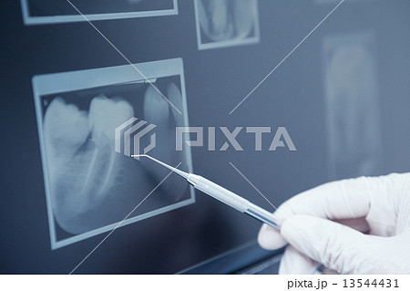 Gloved hand holding dental tool to teeth x-ray 13544431