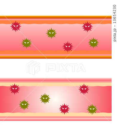 血管内の細菌 13654230