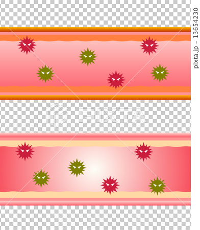 血管内の細菌 13654230
