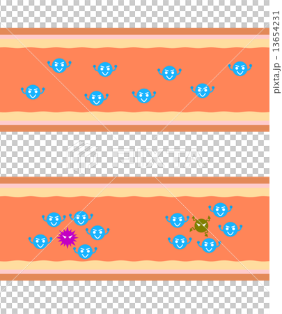 血管中的細菌 13654231