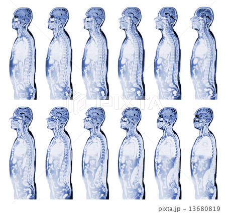 MRI scan 13680819