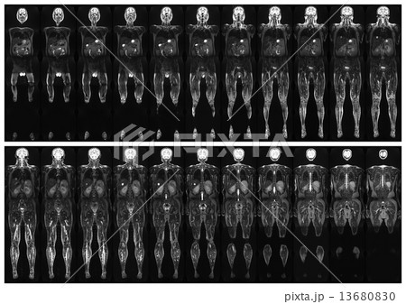 Scan the human body 13680830