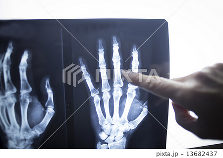 Medical doctor pointing at radiograph x-ray image Medical doctor pointing at radiograph x-ray image 13682437