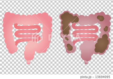 Healthy large intestine constipation colon 13694095